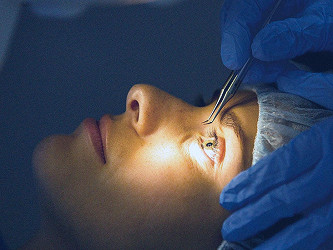 Laser eye surgery: Benefits, risks, and what to expect
